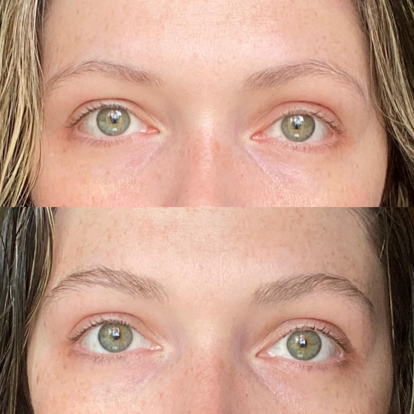 Eyebrow Growth Roller