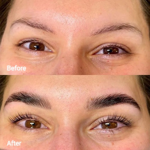 Eyebrow Growth Roller